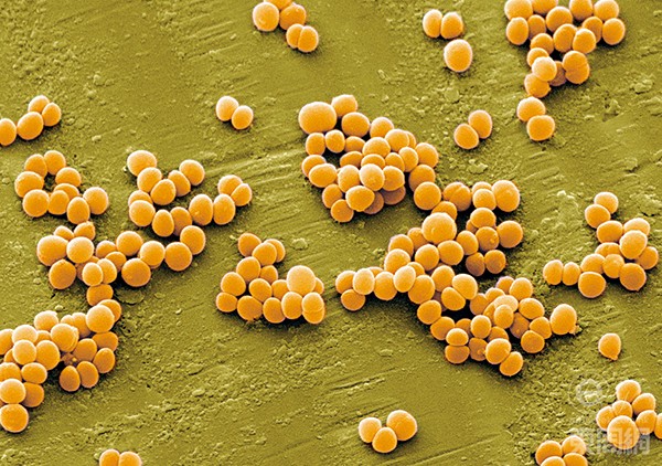 新工具揭示了金葡萄球菌抗生素耐受性的“优雅”机制 第1张