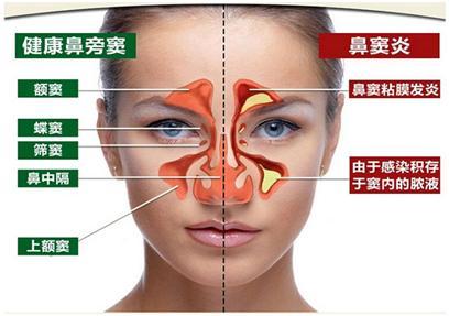 研究人员发现，血统和性别二态性的相互作用显着影响额窦的生长模式 第1张