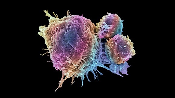 破坏肿瘤细胞:使用注射材料的靶向免疫治疗 第1张
