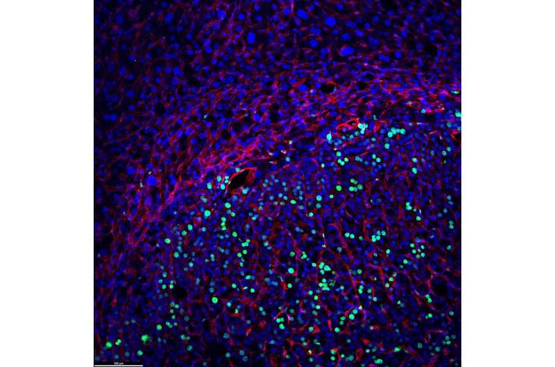 研究人员从脂肪细胞中发现抑制小鼠肿瘤生长的激素 第1张